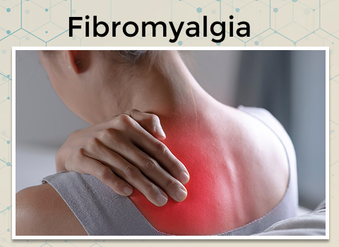 Fibromyalgia